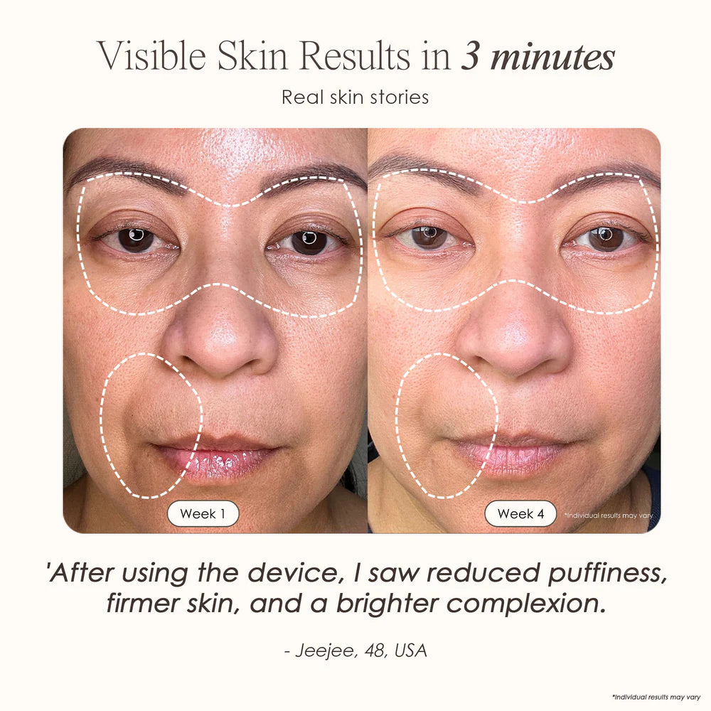 Lemfora Face+ | Pro LED Red Light Therapy Face & Neck Mask