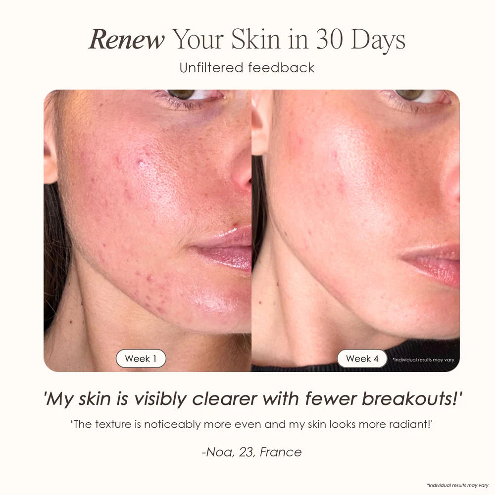 Lemfora Face+ | Pro LED Red Light Therapy Face & Neck Mask