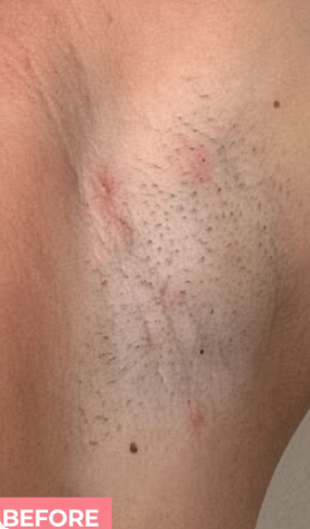 Before