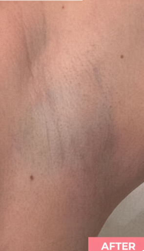 After